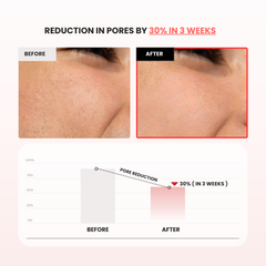 Red Rice Refresh Water Toner